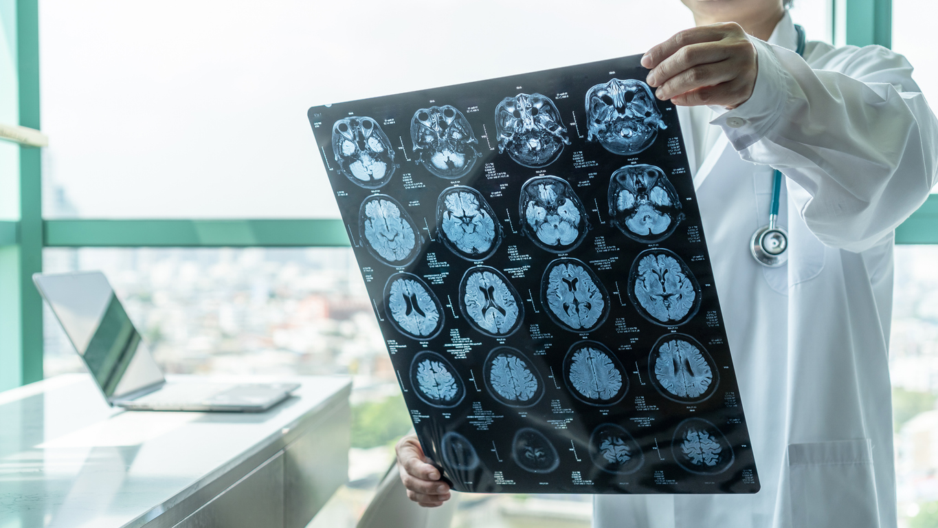 Doctor looking at x-rays of a traumatic brain injury.