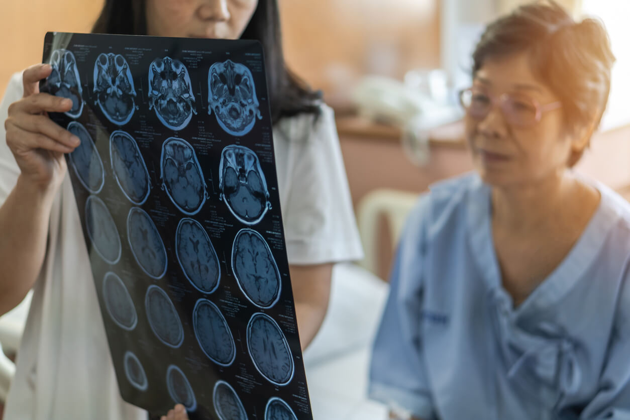 elderly woman with brain scans